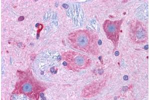 Rat Brain: Formalin-Fixed, Paraffin-Embedded (FFPE)