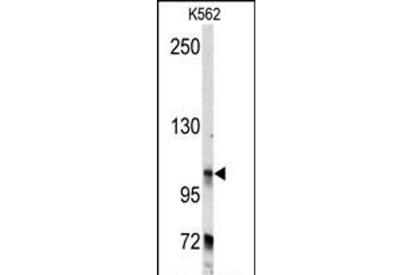 BICD2 antibody  (C-Term)
