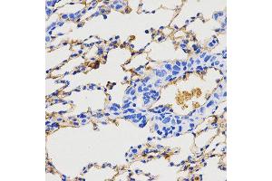 Immunohistochemistry (IHC) image for anti-Neuropeptide Y (NPY) (AA 1-97) antibody (ABIN3017529)