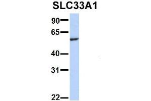 Host:  Rabbit  Target Name:  WT1  Sample Type:  721_B  Antibody Dilution:  1.