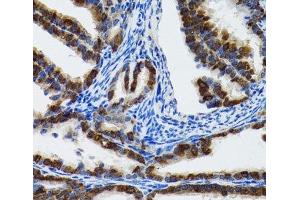Immunohistochemistry of paraffin-embedded Rat fallopian tube using HSPH1 Polyclonal Antibody at dilution of 1:100 (40x lens). (HSPH1 anticorps)