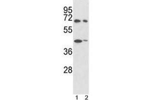 Western blot analysis of SHP2 antibody and 1) 293, 2) K562 lysate. (PTPN11 anticorps  (AA 526-551))