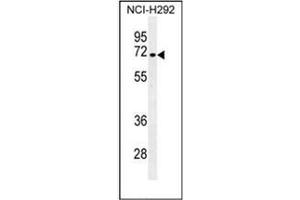 Western blot analysis of NUMB Antibody (N-term) in NCI-H292 cell line lysates (35ug/lane). (NUMB anticorps  (N-Term))