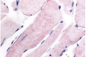 Human Skeletal Muscle (formalin-fixed, paraffin-embedded) stained with WNK1 antibody ABIN213554 at 4 ug/ml followed by biotinylated goat anti-rabbit IgG secondary antibody ABIN481713, alkaline phosphatase-streptavidin and chromogen.