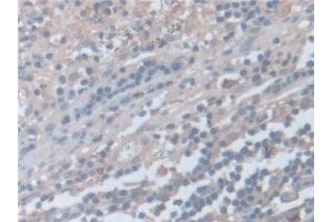 Detection of SNAP23 in Human Appendix Tissue using Polyclonal Antibody to Synaptosomal Associated Protein 23 kDa (SNAP23)