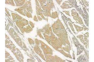ABIN6264963 and ABIN6273315 at 1/100 staining human tongue carcinoma by IHC-P. (SEC63 anticorps  (C-Term))