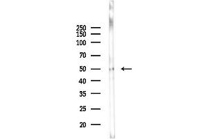 anti-Acyl-CoA Dehydrogenase, Very Long Chain (ACADVL) (Internal Region) antibody