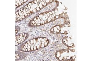 Immunohistochemical staining of human colon with TBC1D14 polyclonal antibody  shows moderate cytoplasmic positivity in glandular cells. (TBC1D14 anticorps)
