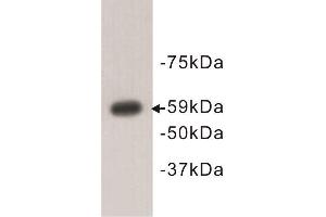 Western Blotting (WB) image for anti-Autoimmune Regulator (AIRE) antibody (ABIN1854830)