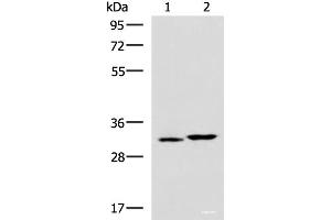 Western blot analysis of 293T cell lysates using CBR3 Polyclonal Antibody at dilution of 1:800 (CBR3 anticorps)