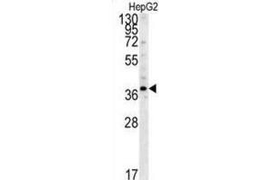 Western Blotting (WB) image for anti-Proteasome (Prosome, Macropain) 26S Subunit, Non-ATPase, 7 (PSMD7) antibody (ABIN3001711) (PSMD7 anticorps)