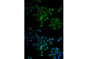 Immunofluorescence analysis of A549 cell using CASP9 antibody. (Caspase 9 anticorps)