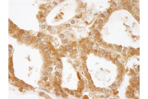 Immunohistochemistry (IHC) image for anti-Coiled-Coil and C2 Domain Containing 1A (CC2D1A) (AA 1-50) antibody (ABIN7448937) (CC2D1A anticorps  (AA 1-50))
