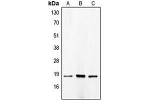 Western blot analysis of p18 INK4c expression in HeLa (A), NIH3T3 (B), COLO205 (C) whole cell lysates.