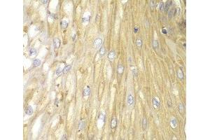 Immunohistochemistry of paraffin-embedded Human esophagus using PPP2R2A Polyclonal Antibody at dilution of 1:100 (40x lens).