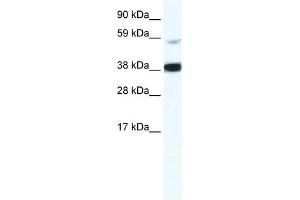 WB Suggested Anti-RELB Antibody Titration:  2. (RELB anticorps  (Middle Region))
