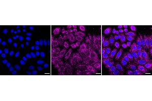 Immunocytochemical staining of HepG2 cells with Glucokinase antibody (ABIN7798729), 1:1,000). (Recombinant GCK anticorps)