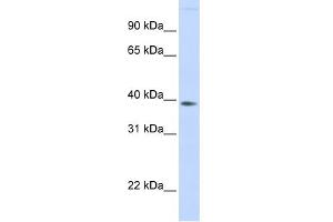 WB Suggested Anti-FAM76B Antibody Titration: 0. (FAM76B anticorps  (Middle Region))