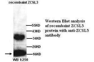 Image no. 1 for anti-DnaJ (Hsp40) Homolog, Subfamily C, Member 24 (DNAJC24) (Internal Region) antibody (ABIN790925)