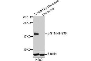 Western blot analysis of extracts of K-562 cells, using Phospho-STMN1-S38 antibody (ABIN2987644). (Stathmin 1 anticorps  (pSer38))