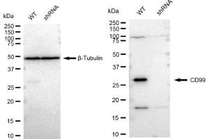 Western blotting analysis using CD99 antibody (ABIN7797990).