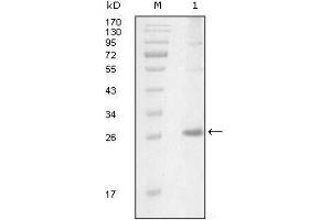 Western Blot showing ITK antibody used against truncated Trx-ITK recombinant protein (1). (ITK anticorps  (AA 2-110))