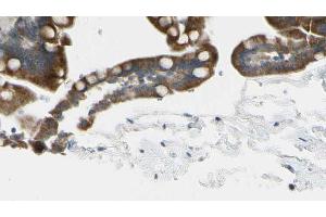 ABIN6268853 at 1/100 staining Mouse intestine tissue by IHC-P. (CRHR2 anticorps  (Internal Region))