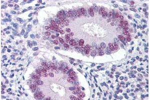 Human Uterus: Formalin-Fixed, Paraffin-Embedded (FFPE) (STK17A anticorps  (AA 301-414))