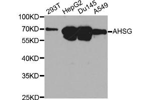 Western blot analysis of extracts of various cell lines, using AHSG antibody. (Fetuin A anticorps)