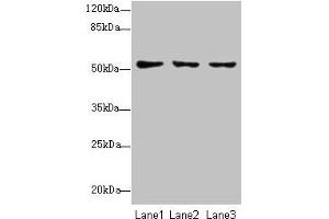 Western blot All lanes: SLC46A2 antibody at 8 μg/mL Lane 1: HT29 whole cell lysate Lane 2: Mouse liver tissue Lane 3: Mouse kidney tissue Secondary Goat polyclonal to rabbit IgG at 1/10000 dilution Predicted band size: 52 kDa Observed band size: 52 kDa (SLC46A2 anticorps  (AA 45-78))