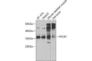 Western blot analysis of extracts of various cell lines, using PYCR1 antibody (ABIN6133044, ABIN6146518, ABIN6146520 and ABIN6222710) at 1:1000 dilution. (PYCR1 anticorps  (AA 1-319))