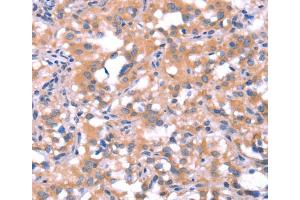 Immunohistochemistry (IHC) image for anti-FAT Tumor Suppressor Homolog 1 (FAT1) antibody (ABIN2434638) (FAT1 anticorps)