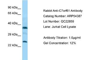 Western Blotting (WB) image for anti-Chromosome 7 Open Reading Frame 61 (C7orf61) (C-Term) antibody (ABIN2785686) (C7orf61 anticorps  (C-Term))
