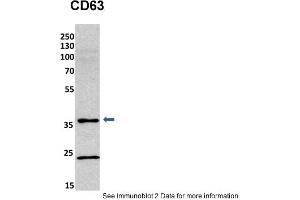 Sample Type: mouse fibroblast lusate (20ug)Primary Dilution: 1:800 (2% milk)Secondary Dilution: 1:2000 (5% milk)Image Submitted By: Anonymous researcher . (CD63 anticorps  (C-Term))