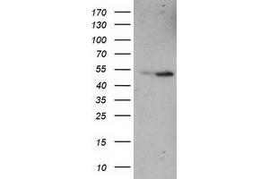 Western Blotting (WB) image for anti-Eukaryotic Translation Termination Factor 1 (ETF1) antibody (ABIN1498129) (ETF1 anticorps)