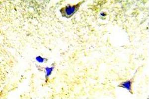 Immunohistochemistry (IHC) analyzes of PAK1/2 antibody in paraffin-embedded human brain tissue. (PAK1 anticorps)
