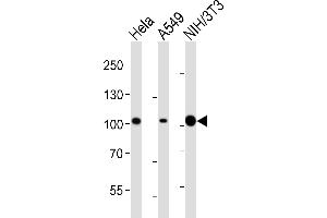 Western blot analysis of lysates from Hela, A549, mouse NIH/3T3 cell line (from left to right), using FER Antibody (ABIN6243360 and ABIN6577092). (FER anticorps  (AA 1-300))