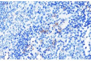 Immunohistochemistry of paraffin-embedded Mouse spleen using CD11A Polyclonal Antibody at dilution of 1:100 (40x lens).