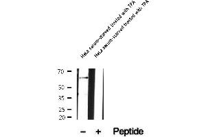 Western blot analysis of extracts of HeLa serum-starved treated with TPA , using Phospho-FOS (Ser32) Antibody.
