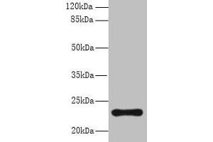 Western blot All lanes: AP3S2 antibody at 6 μg/mL + A549 whole cell lysate Secondary Goat polyclonal to rabbit IgG at 1/10000 dilution Predicted band size: 23, 44, 15 kDa Observed band size: 23 kDa