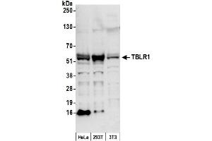 Western Blotting (WB) image for anti-Transducin (Beta)-Like 1 X-Linked Receptor 1 (TBL1XR1) (AA 100-150) antibody (ABIN7453451)