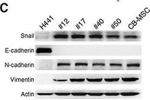 Fusion progeny exhibit epithelial-mesenchymal transition(A) Representative phase-contrast microscopic images of fusion progeny and parental cells. (Vimentin anticorps)