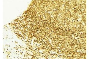 ABIN6269040 at 1/100 staining Mouse liver tissue by IHC-P.