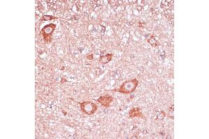 Immunohistochemistry of paraffin-embedded mouse spinal cord using RPL32 antibody (ABIN6129104, ABIN6147138, ABIN6147139 and ABIN6216824) at dilution of 1:100 (40x lens).