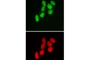 SMARCB1 antibody (mAb) (Clone 2C2) tested by immunofluorescence. (SMARCB1 anticorps)