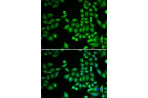 Immunofluorescence analysis of MCF-7 cells using PTPN1 antibody (ABIN5970769). (PTPN1 anticorps)