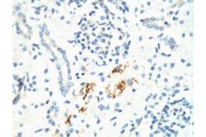 IHC staining of Mouse Kidney tissue, diluted at 1:200. (KIF7 anticorps)