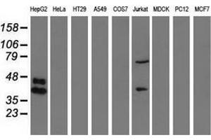 Western blot analysis of extracts (35 µg) from 9 different cell lines by using anti-HP monoclonal antibody. (Haptoglobin anticorps)