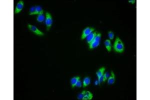 Immunofluorescence staining of HepG2 cells with ABIN7145704 at 1:333, counter-stained with DAPI.