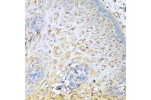 Immunohistochemistry of paraffin-embedded human esophagus using MYH9 antibody.
